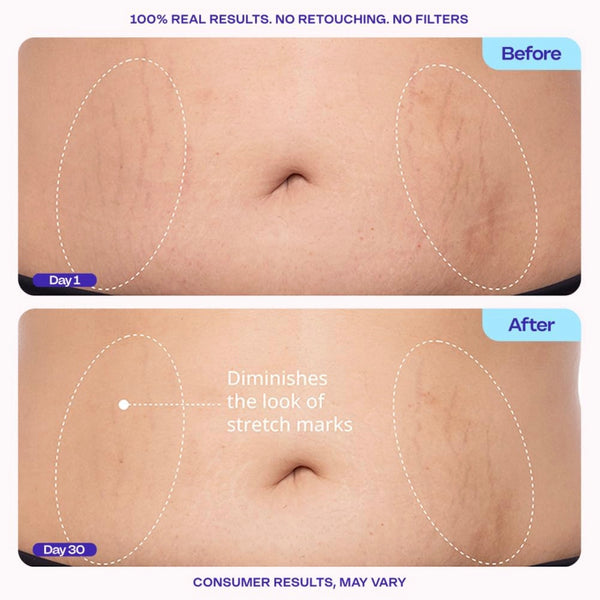 GOPURE Tighten & Smooth Belly Cream