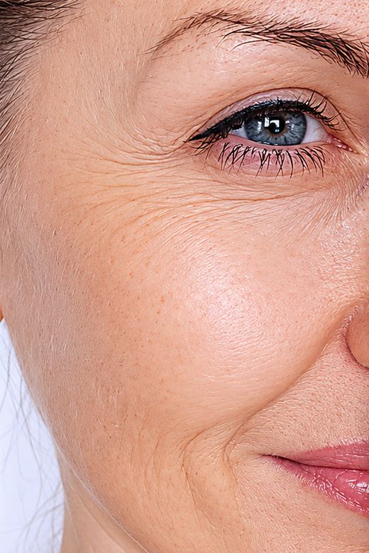 Close-up of mature skin looking dry and dull before hydration
